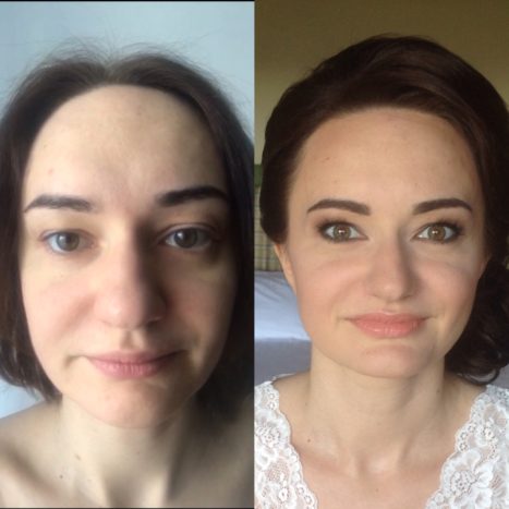 prima e dopo