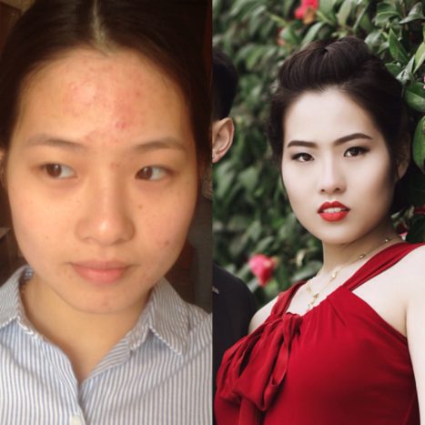 prima e dopo
