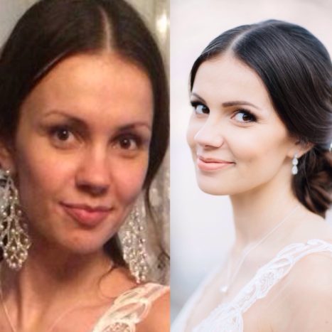 prima e dopo