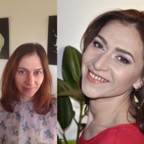 prima e dopo